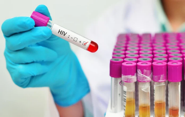 Leia mais sobre o artigo Mortes por aids na Paraíba seguem tendência nacional e caem em 3%