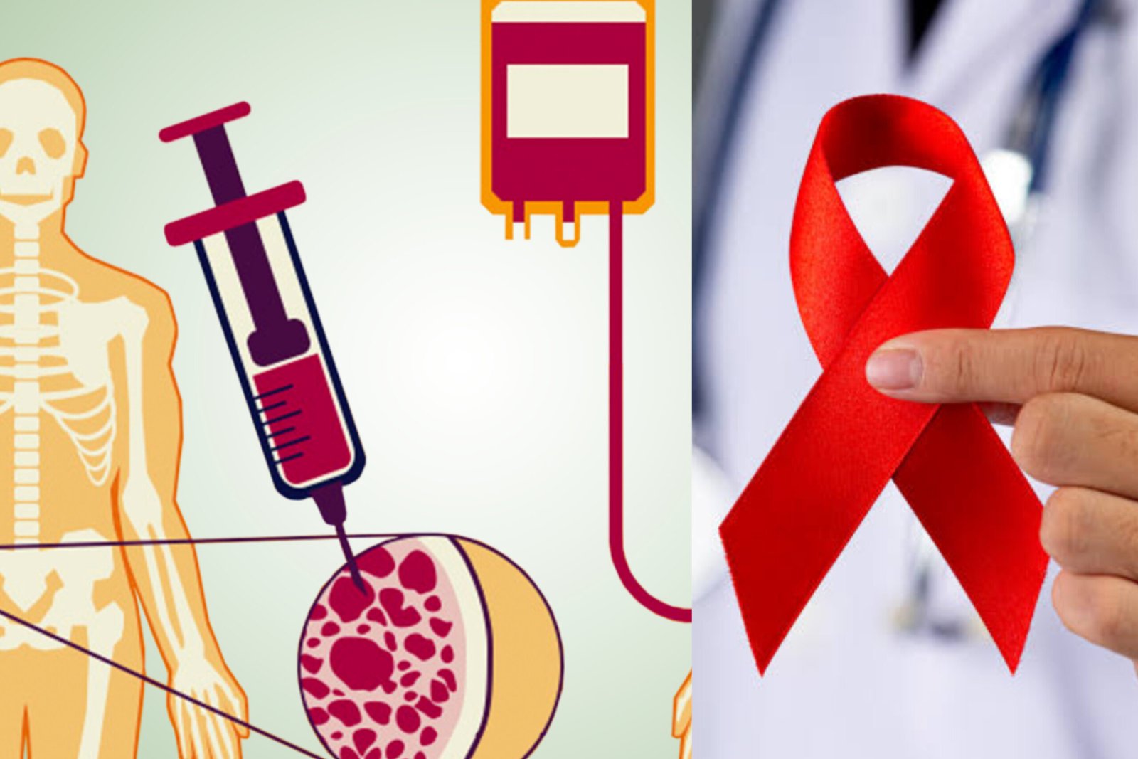 Leia mais sobre o artigo Estudos registram mais dois casos de remissão do HIV após transplante de células-tronco; já são 13 casos registrados